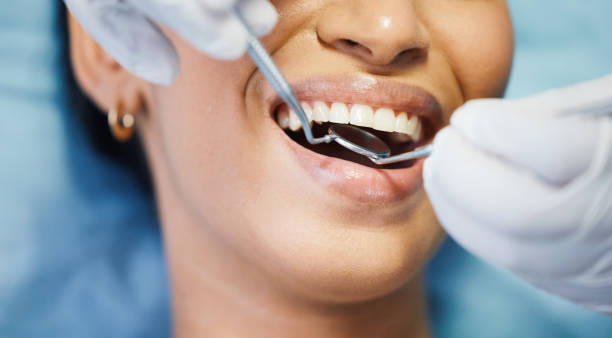 Best Emergency Denture Repair in Port Allen, LA